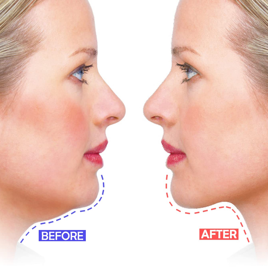 Genève LED Mask - Light Therapy