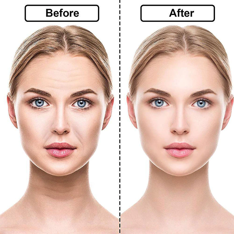 Genève LED Mask - Light Therapy