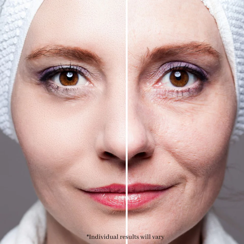 Genève™ Facial Toning Device